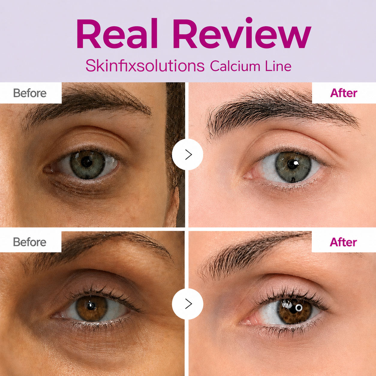 🔥LAST DAY 50% OFF!! SkinFixSolutions Korean Calcium Dark Spot Eye Cream