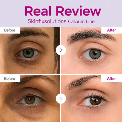🔥LAST DAY 50% OFF!! SkinFixSolutions Korean Calcium Dark Spot Eye Cream