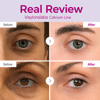 🔥LAST DAY 50% OFF!! VeyloraLabs Korean Calcium Dark Spot Eye Cream